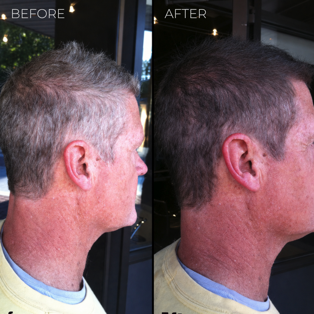Bruzlo™ Instant Gray Coverage Stick for Men
